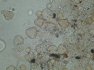 Analiza pyłkowa miodów